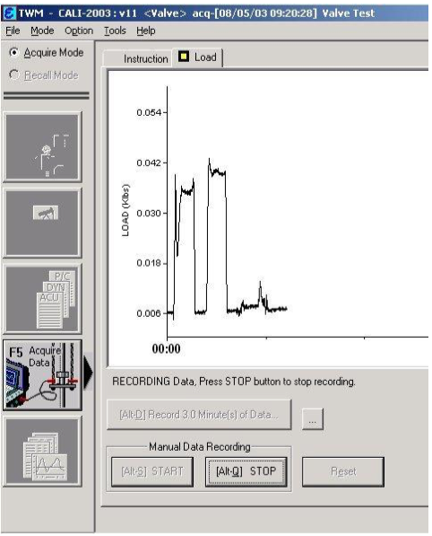 Echometer TWM Valve Test